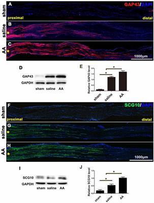 Ascorbic Acid Facilitates Neural Regeneration After Sciatic Nerve Crush Injury